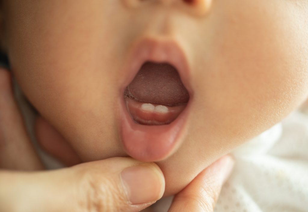 dientes de leche