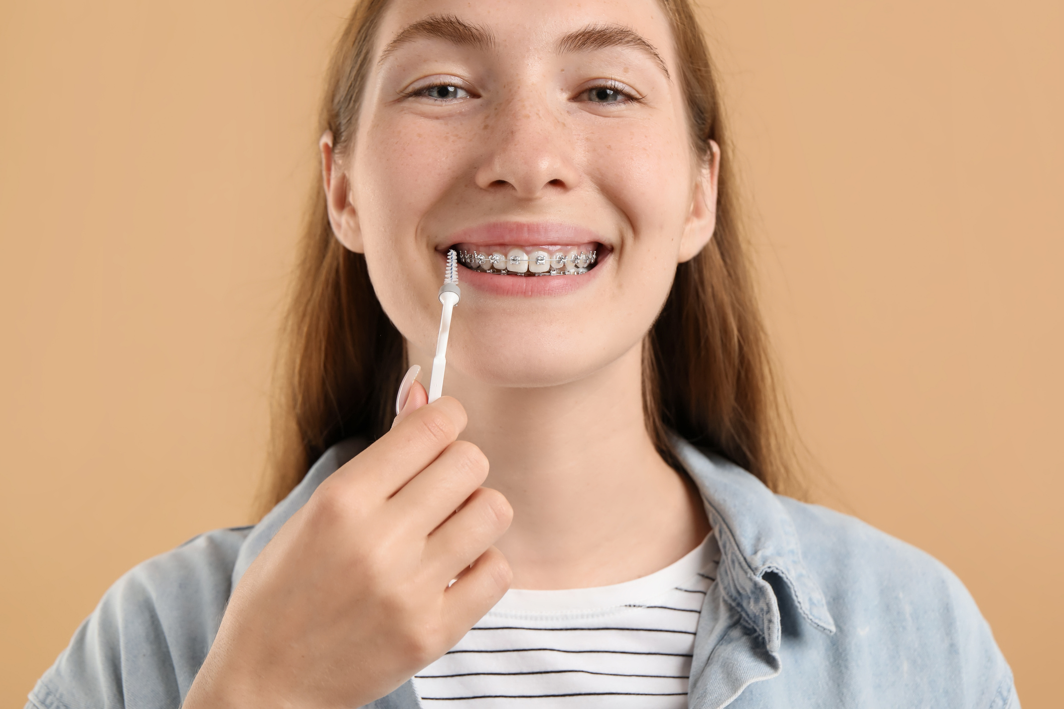 Cuidado de los dientes en pacientes con ortodoncia fija