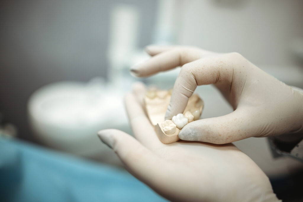 corona dental